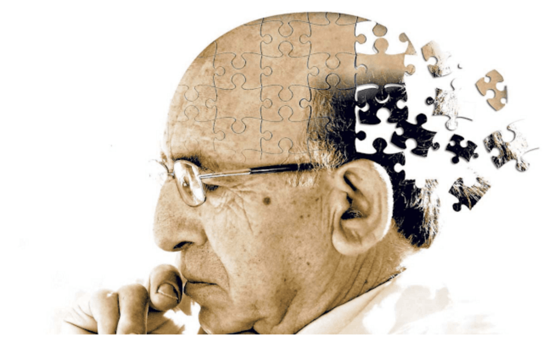One Simple Way To Decrease Your Risk of Alzheimer’s Disease - ScrapeYourTongue.com